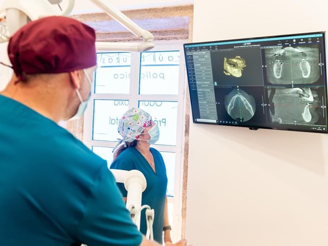 5 consejos para el mantenimiento de sus implantes dentales