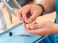 5 mitos sobre los implantes dentales