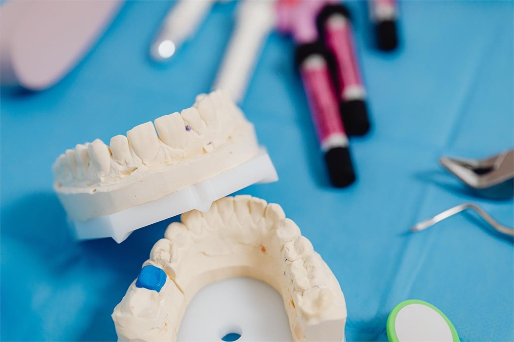 ¿De qué material son los implantes dentales?