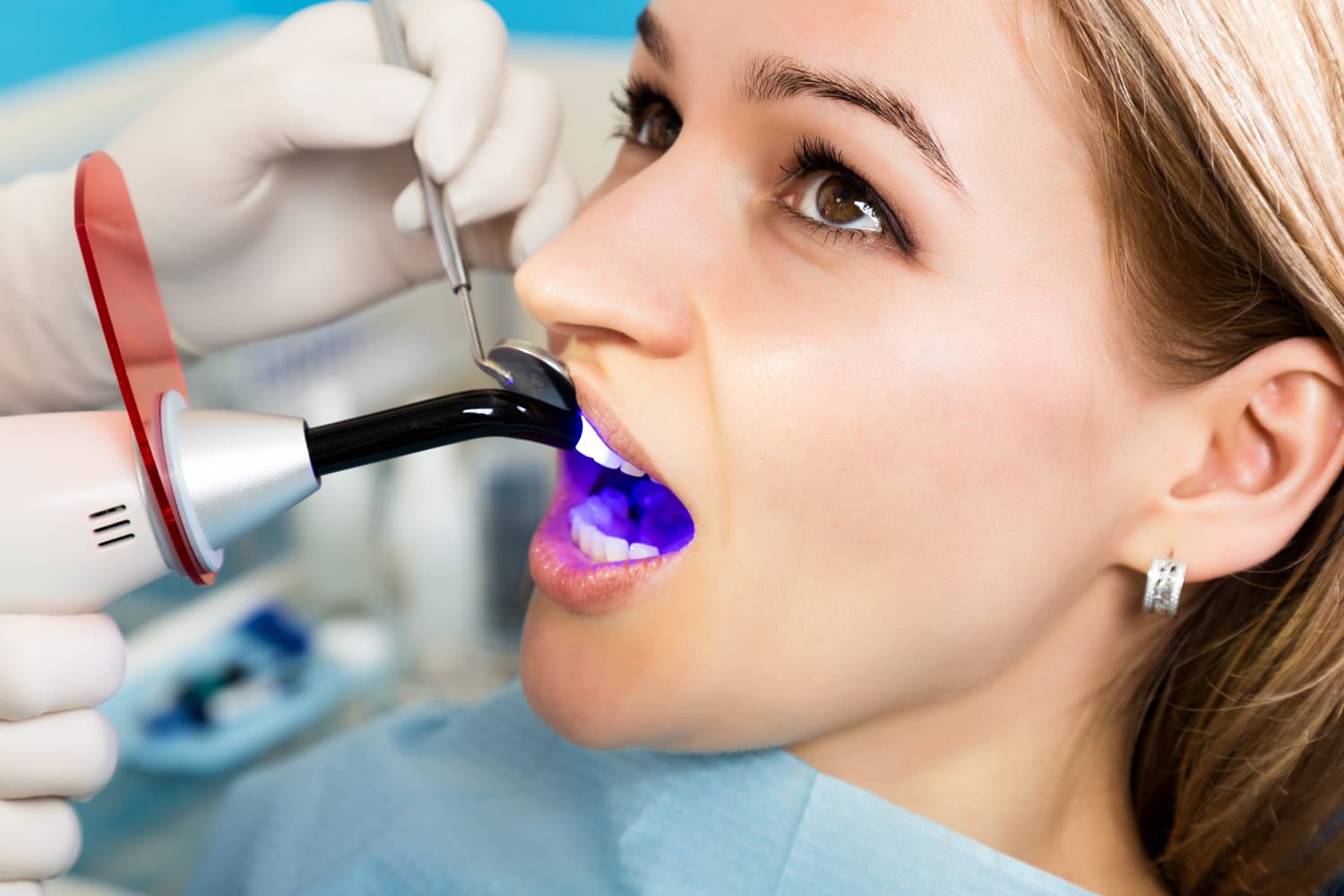 Blanqueamiento dental en Muros y Milladoiro