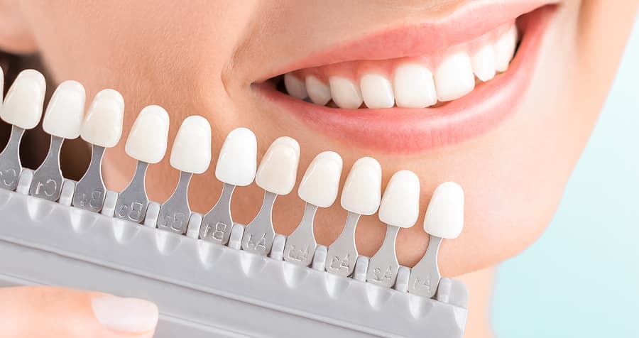 Resultado de un tratamiento de estética dental en la clínica de Muros