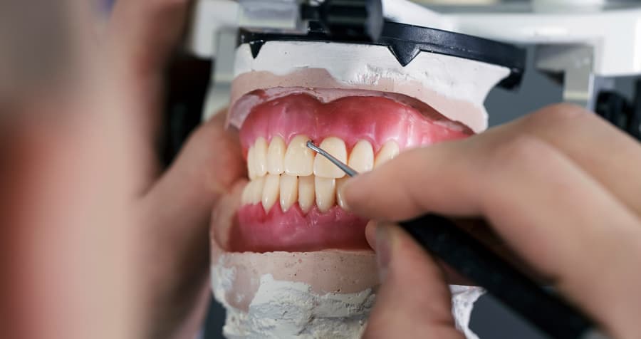 Prótesis dental fija sobre modelo en la clínica dental de Muros