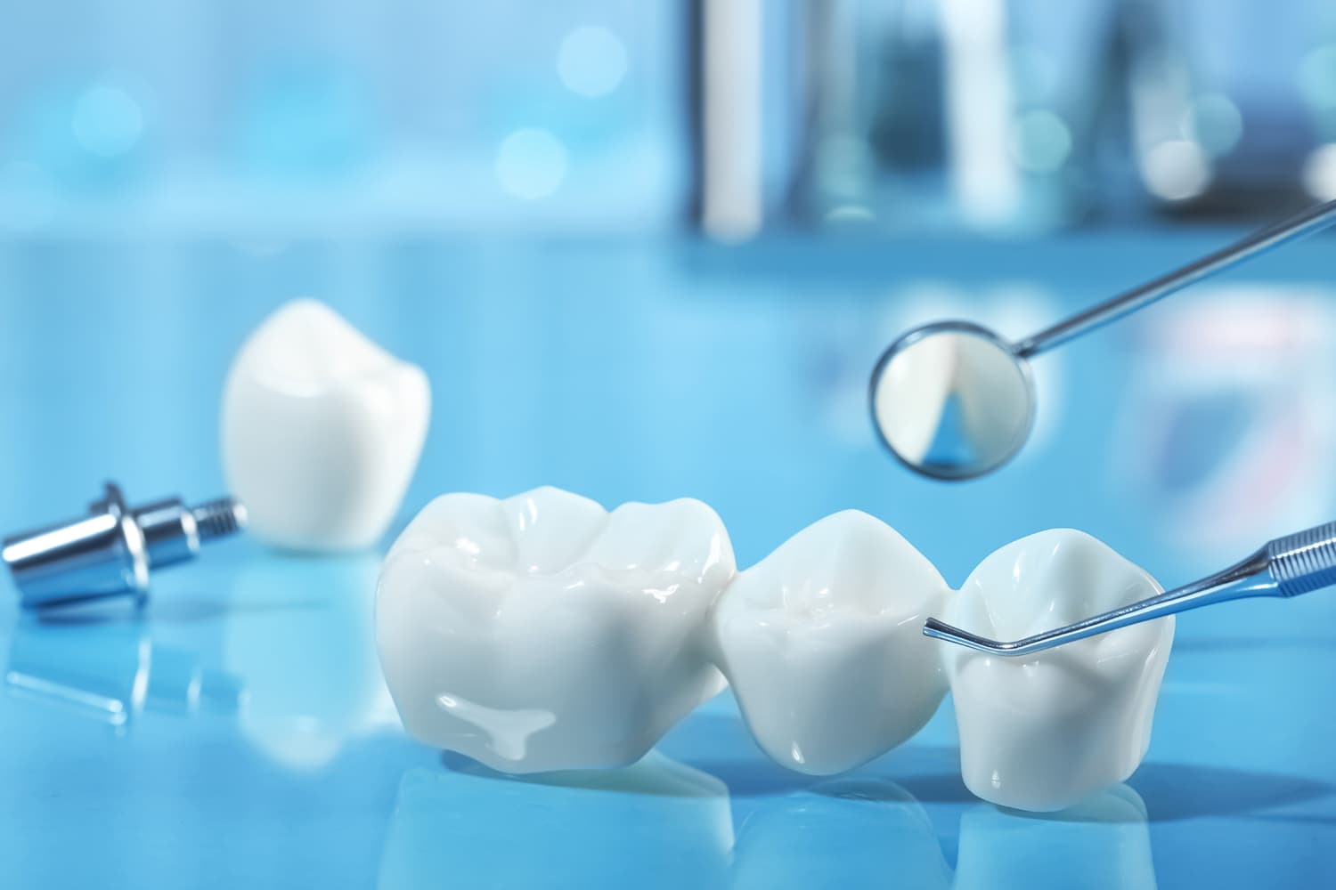 ¿Cuánto duran las prótesis dentales?