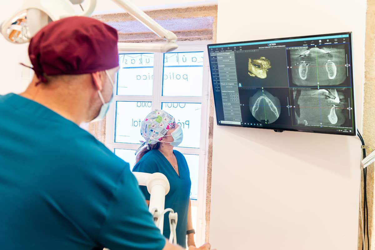 Implantes dentales en Muros con tac 3d