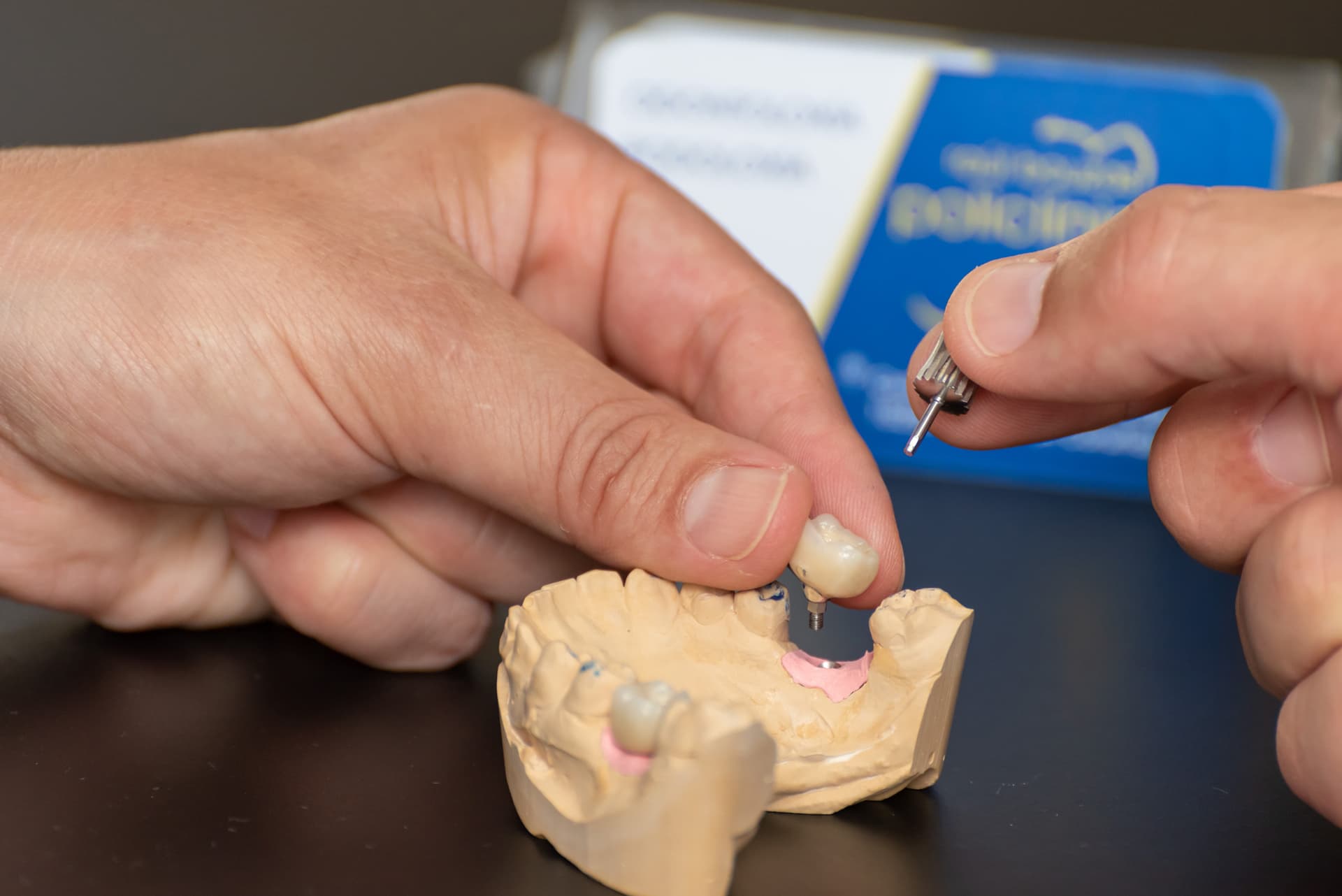 Paciente con una pieza dental perdida en la consulta del dentista en Muros