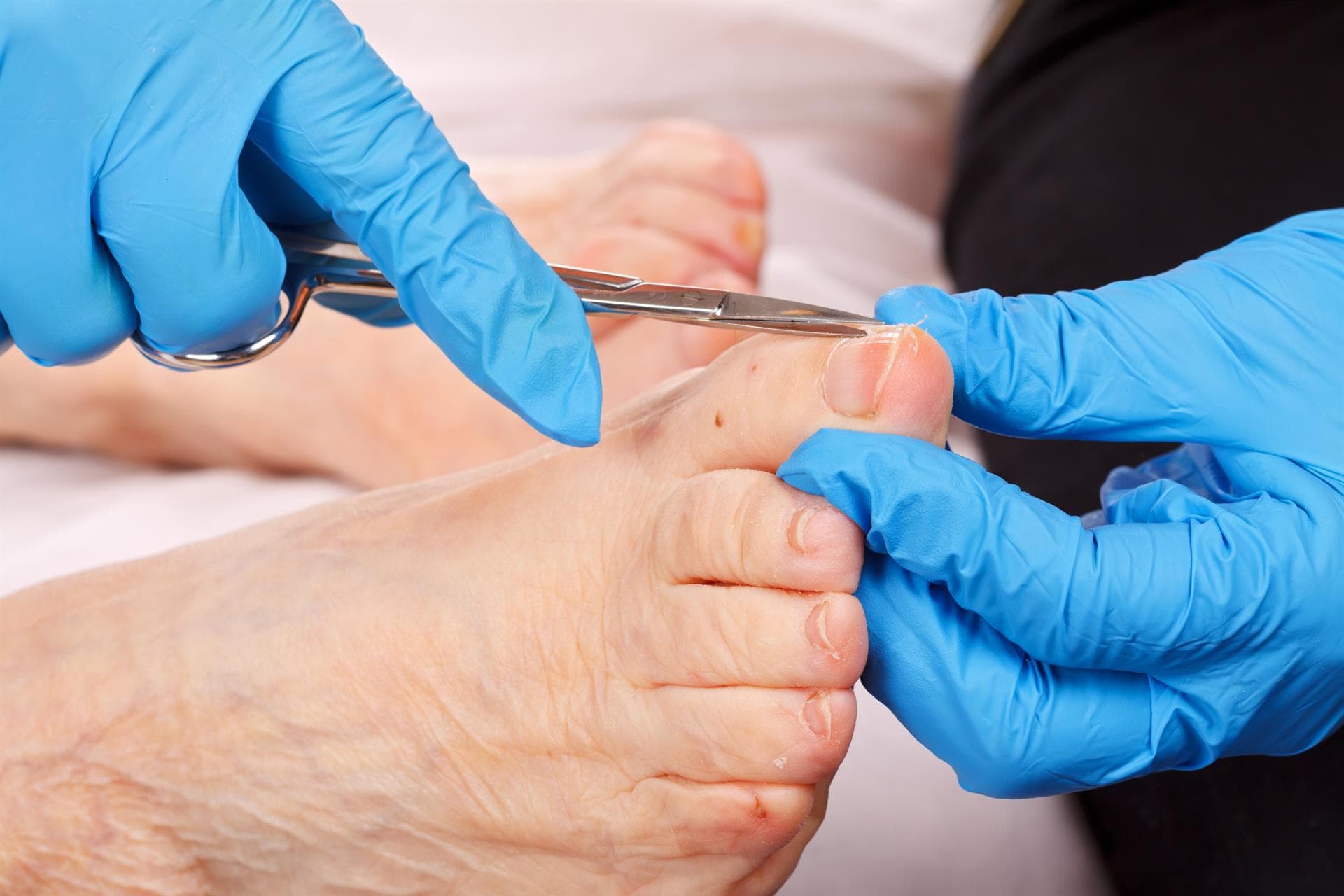 Podología geriátrica en Muros y Milladoiro