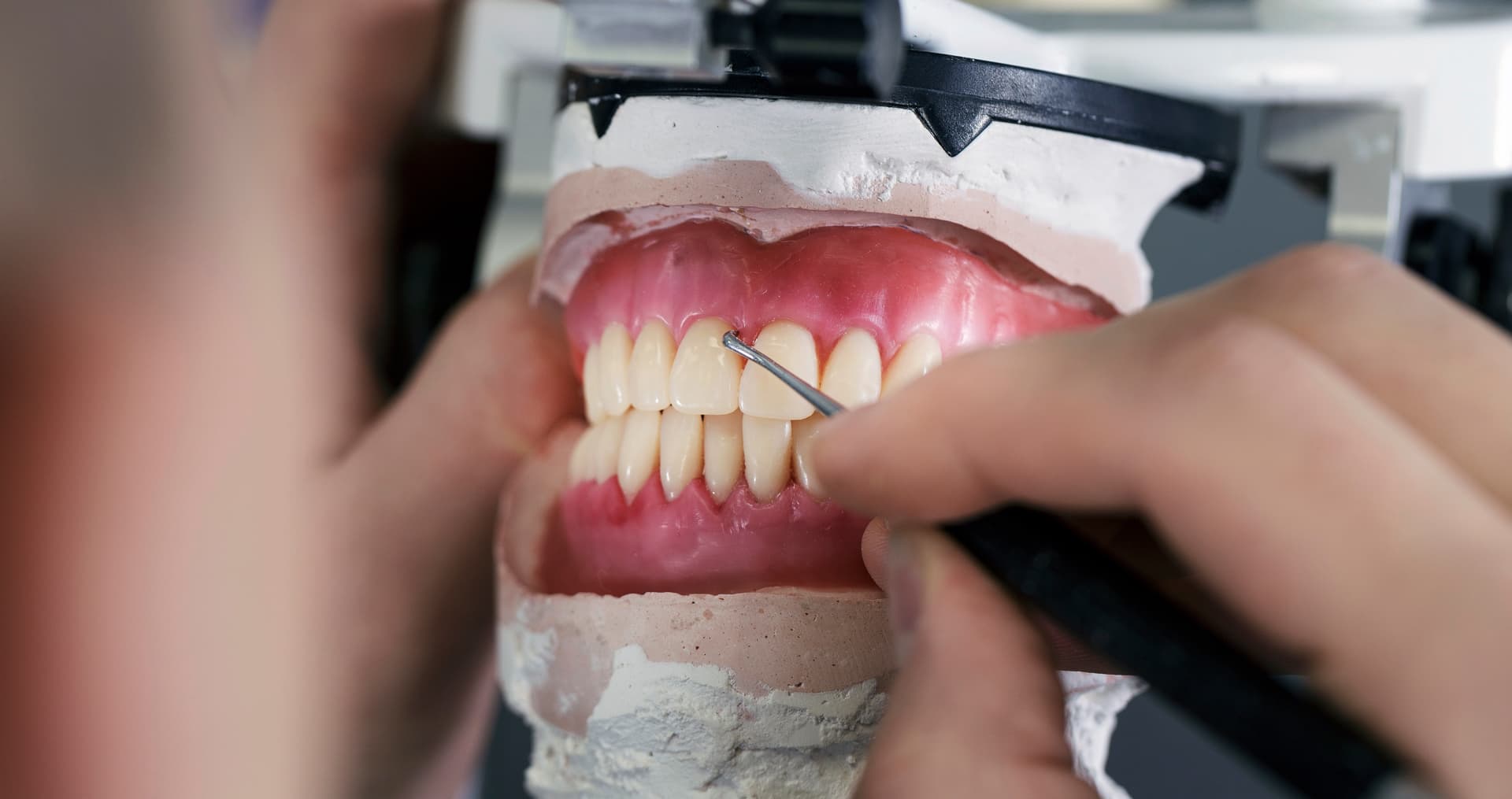 Opte por nuestras prótesis dentales en Muros