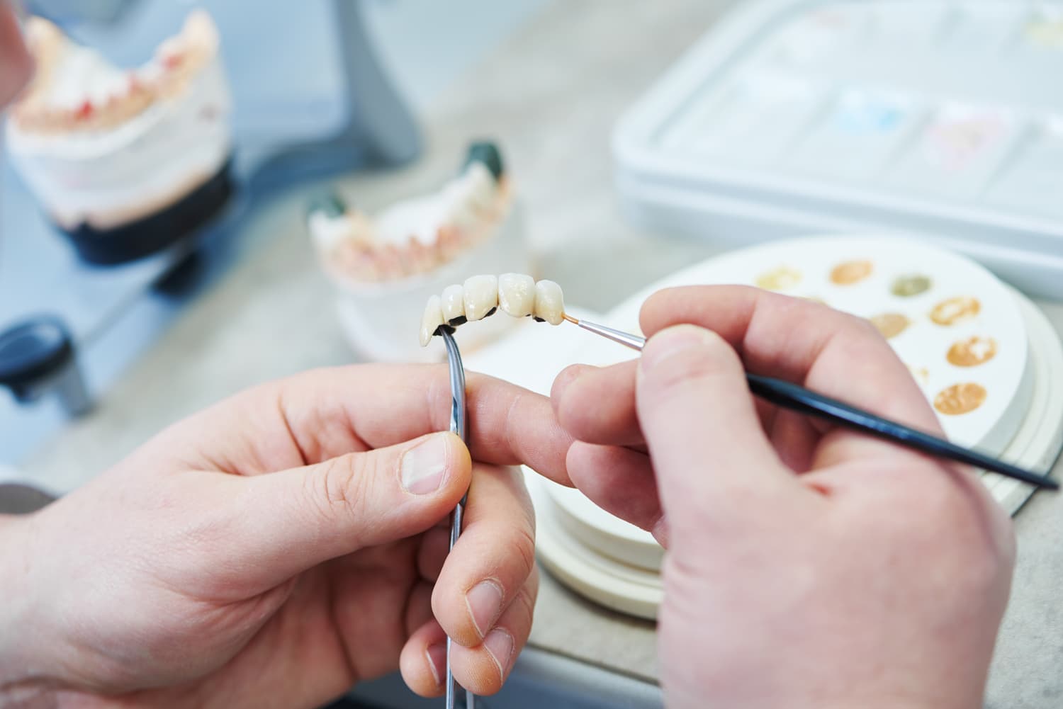 prótesis dentales en Milladoiro y Muros