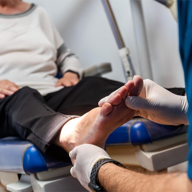 ¿Qué es la hiperhidrosis plantar?