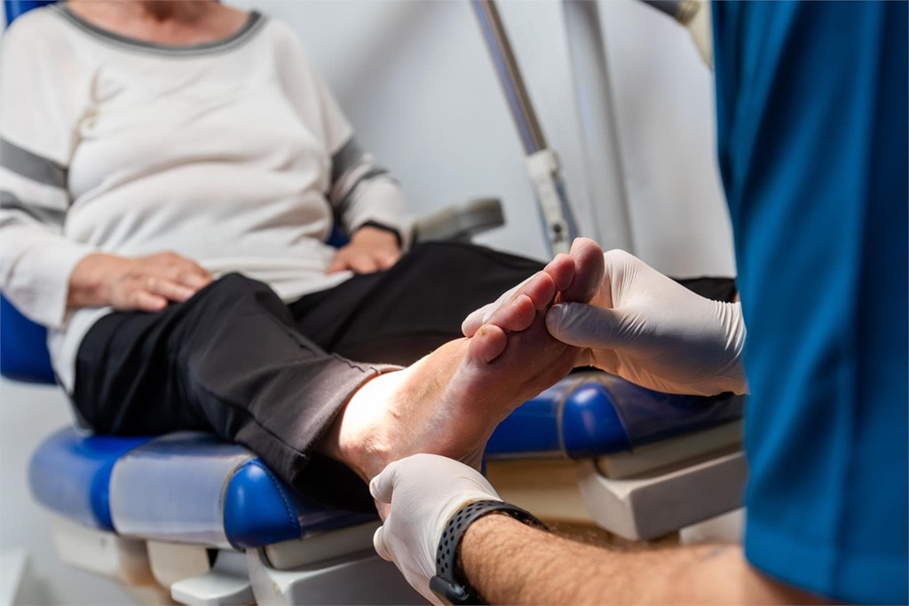 ¿Qué es la hiperhidrosis plantar?